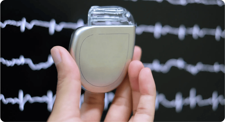 Implantable Cardioverter-Defibrillator ICD - Life-Saving Heart Device